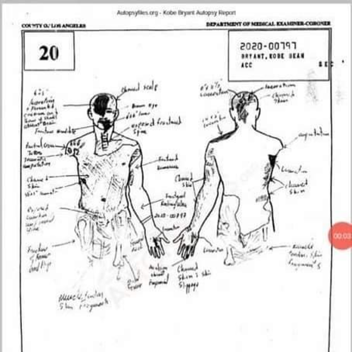 Kobe Autopsy – Kobe Bryant Autopsy Report Sketch Surface Online