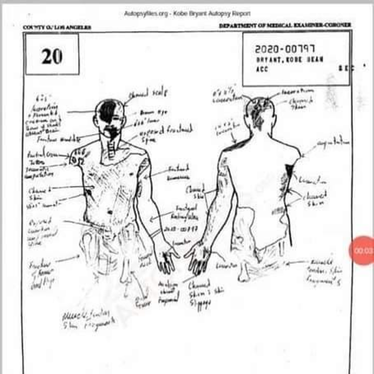 Real kobe bryant autopsy report pdf & Twetter